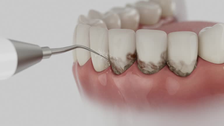 Reliable Dental contractor in Bexley, OH by Dentist Open Now